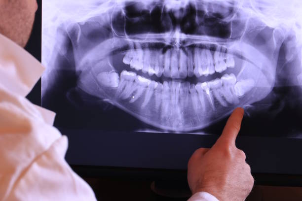 Best Emergency Treatment for Dental Infections or Abscesses in New Berlin, WI