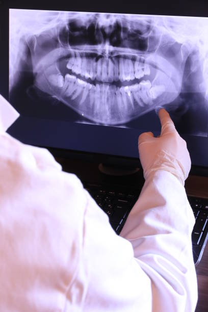 Best Emergency Dental Care for Broken or Chipped Teeth in New Berlin, WI